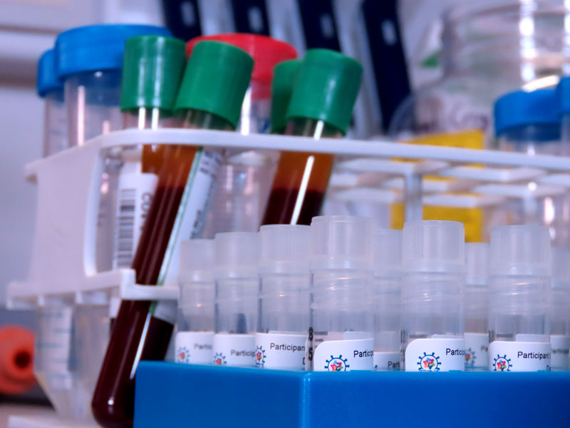 Cryovials and blood samples from the first volunteer to receive Oxford's COVID-19 vaccine. Photo by Sean Elias