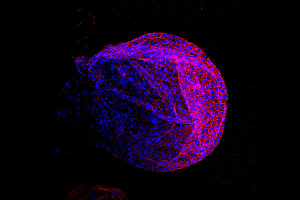 Microscopic cells derived from KRAS mutated model: a spherical structure covered in blue and red clusters 